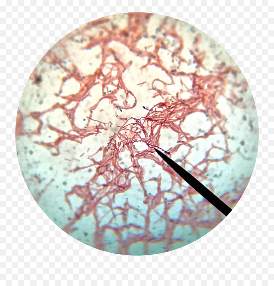 Bacillus Subtilis Endospore Stain - Bacillus Subtilis Endospore Stain Png,Stain Png