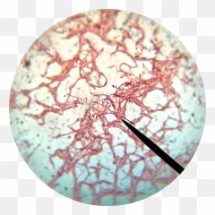 Bacillus Subtilis Endospore Stain - Bacillus Subtilis Endospore Stain Png,Stain Png