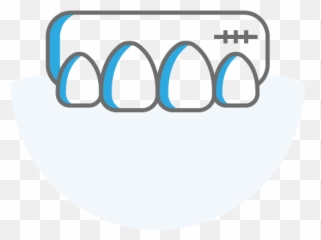 Best Dental Implants Abroad - Clinic Monterrey Mexico png