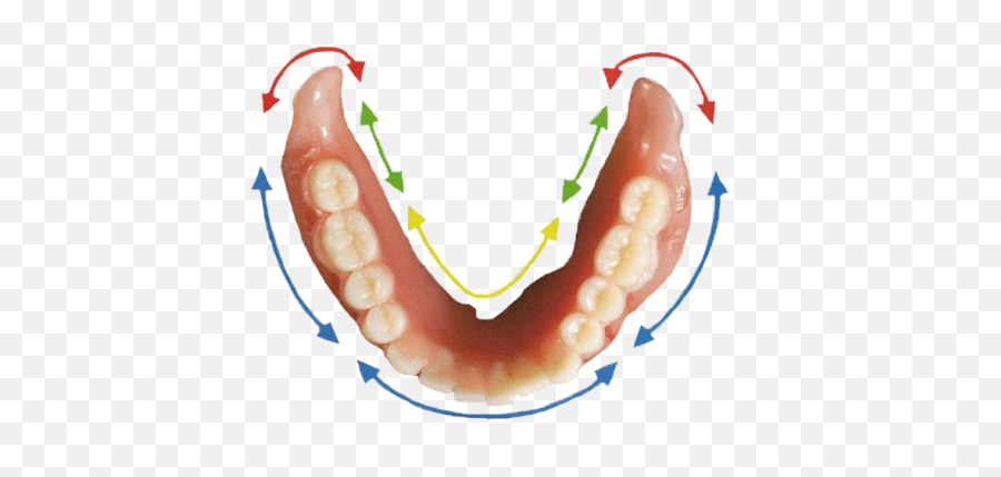 What Is A Semcd Or Suction Denture Aldergrove - Lower Suction Denture Png,Dentures Png