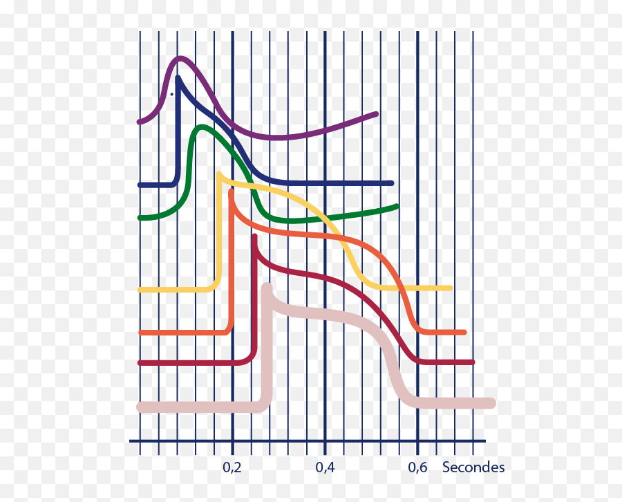 Ekg - Plot Png,Ekg Png