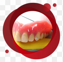 Denture Teeth Jewellery Png Dentures