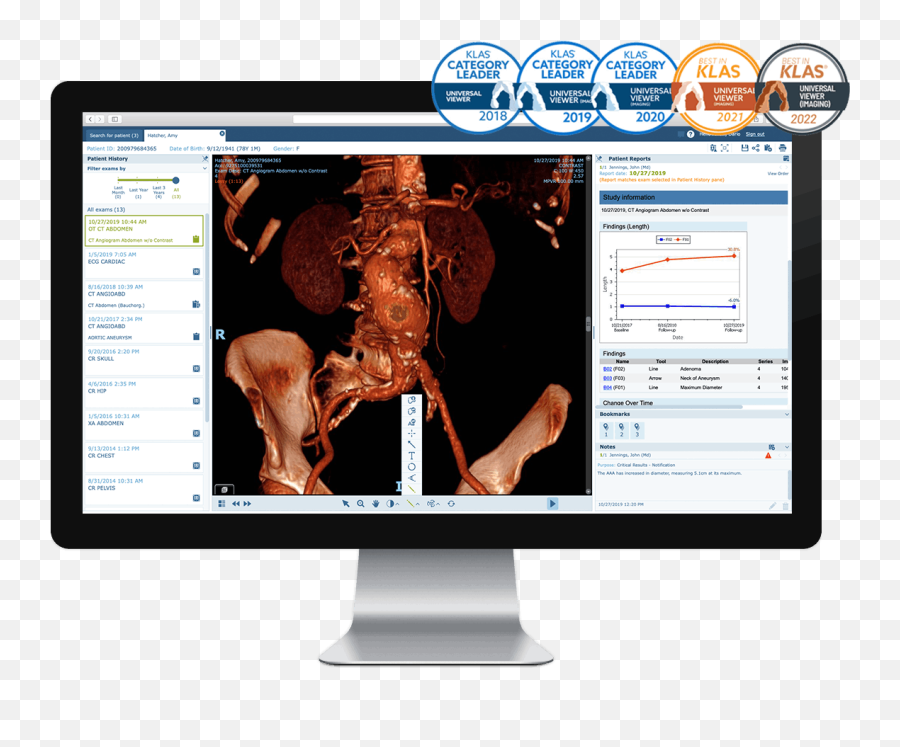 Medical Image Sharing U0026 Exchange Solutions Philips Healthcare - Language Png,Elekta Icon