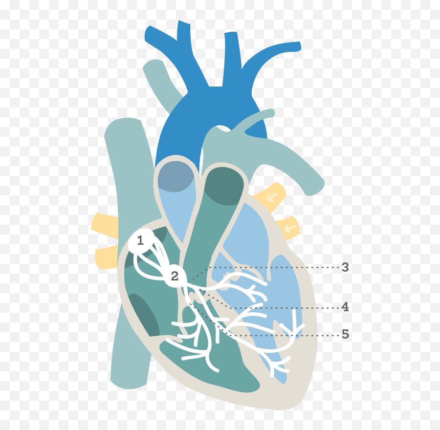 What Is An Ecg - Electrocardiogram Png Clipart,Ekg Png