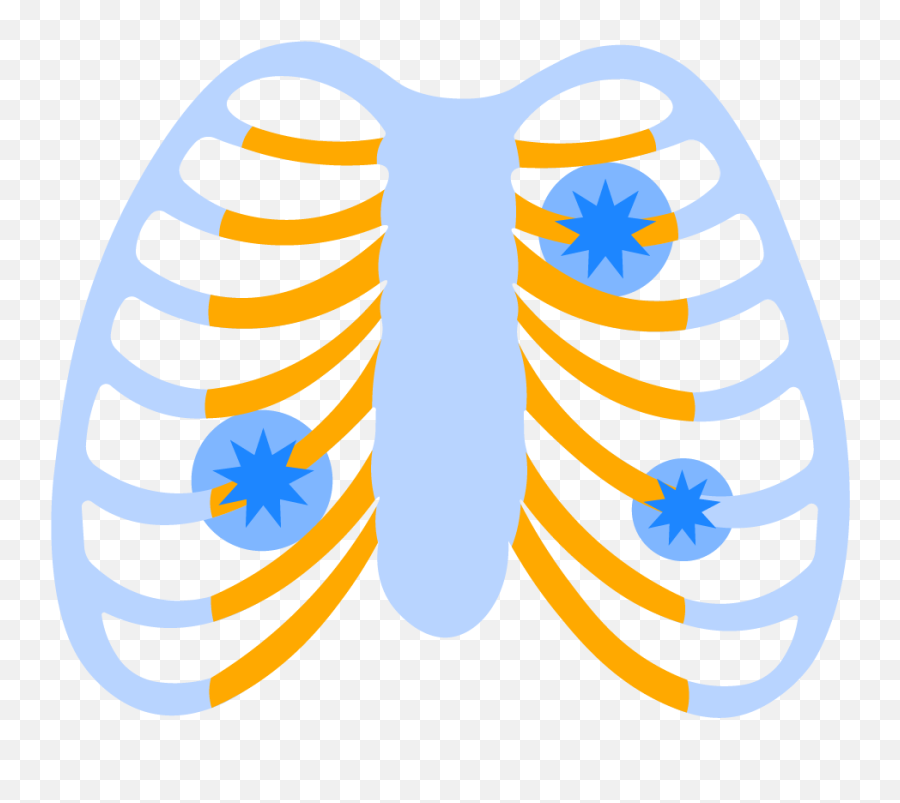 Acute Costochondritis Symptoms U0026 Treatment Of Chest Wall Pain Png Icon Pop Quiz Characters Level 7