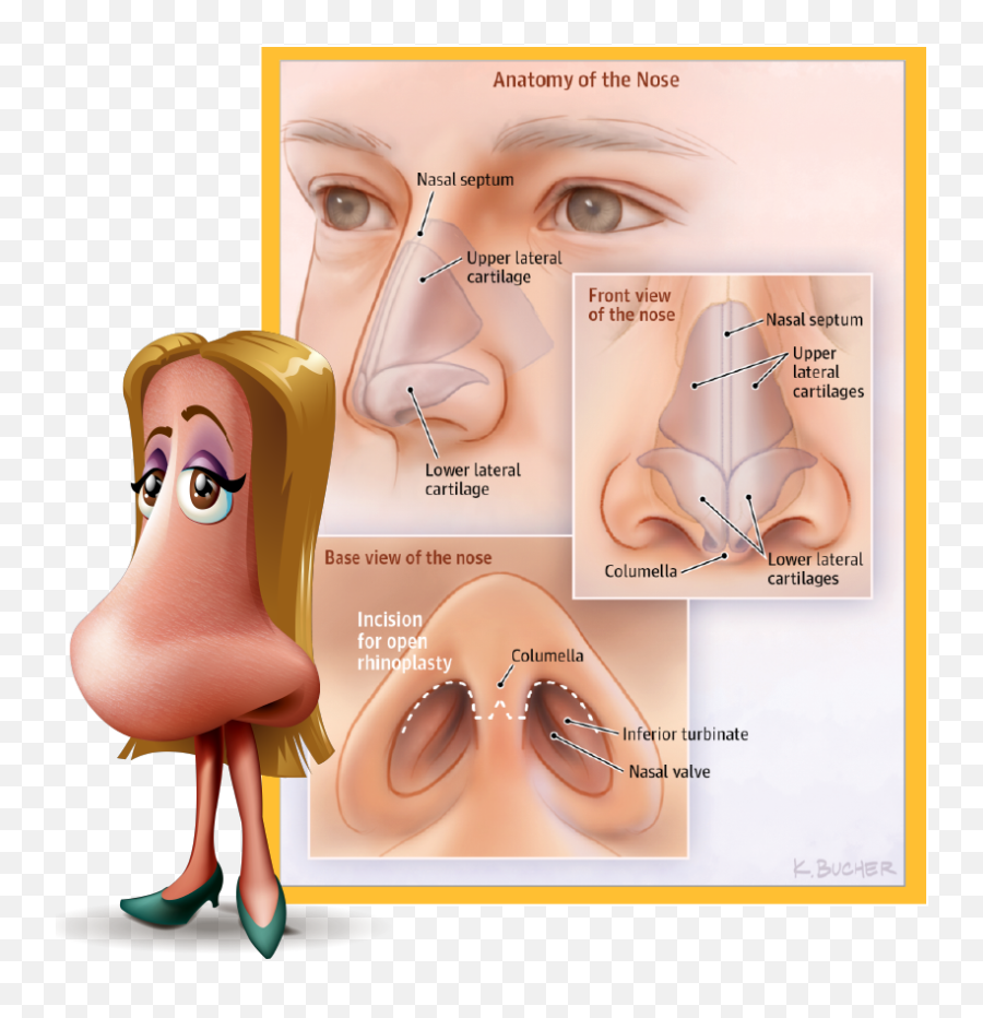 Download Rhinoplasty Commonly Known As - Scar Tissue After Rhinoplasty Png,Rudolph Nose Png