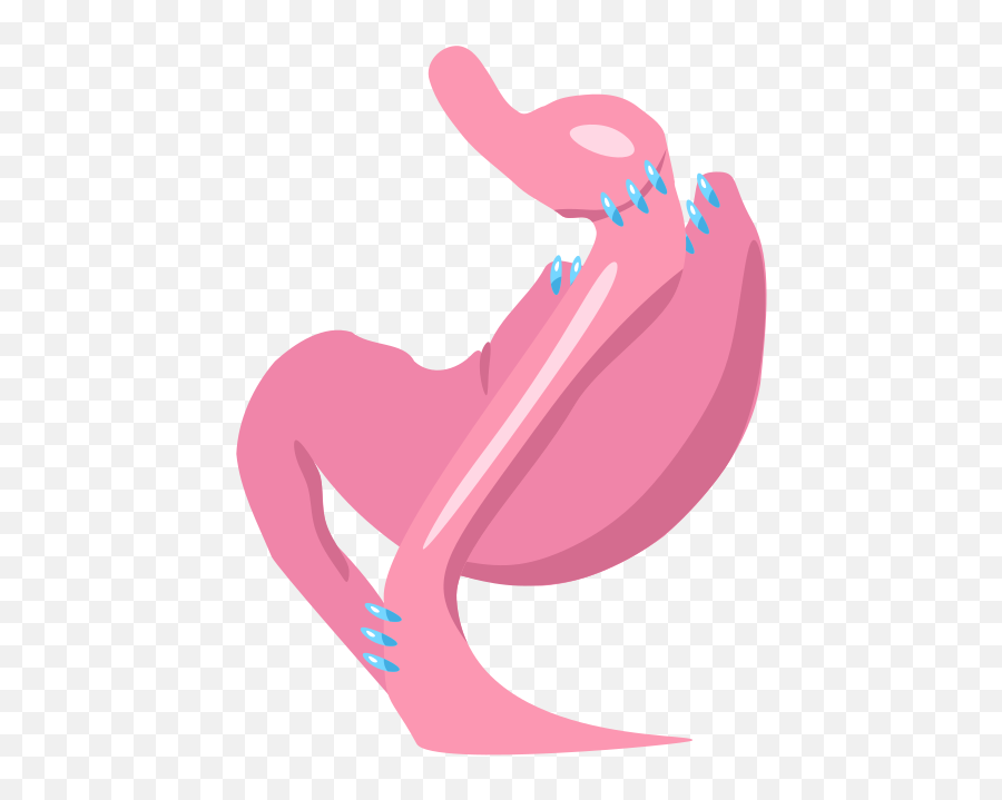 Gastric Bypass Surgery - Wikipedia Gastric Embolization Procedure Png,In Case Icon Sleeve