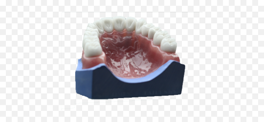 Removables U2014 Gcdl - Tongue Png,Dentures Png
