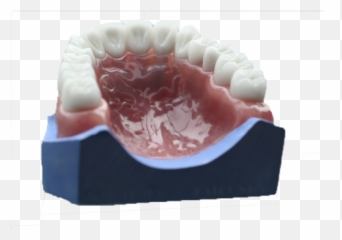 Removables U2014 Gcdl - Tongue Png,Dentures Png