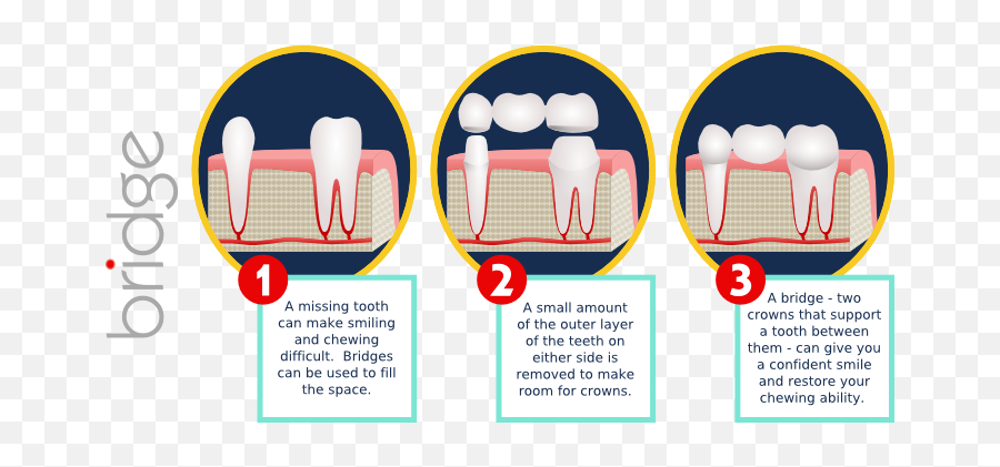 From Missing Teeth - The Royal Enfield Png,Smile Teeth Png