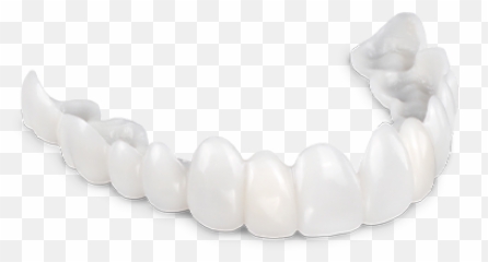 Products U0026 Services - Dental Masters Snap On Smile Png