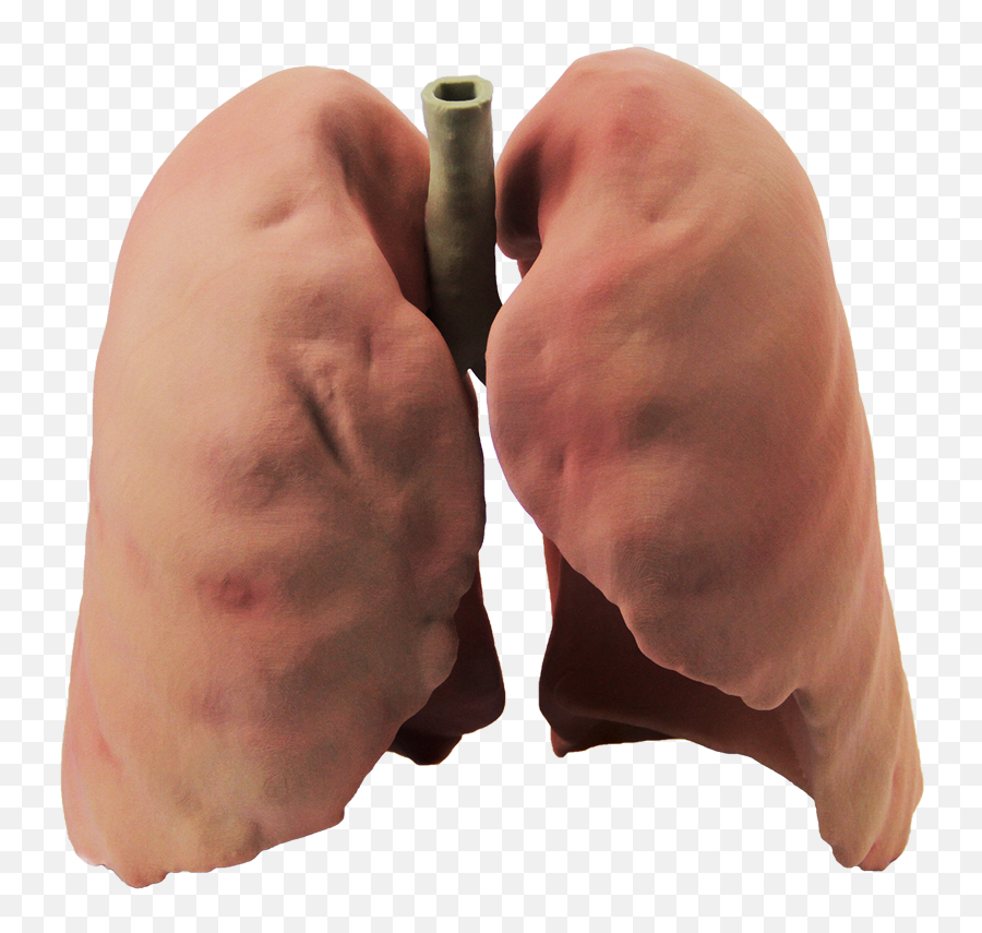 Lungs Png - Real Lung Png,Lung Png