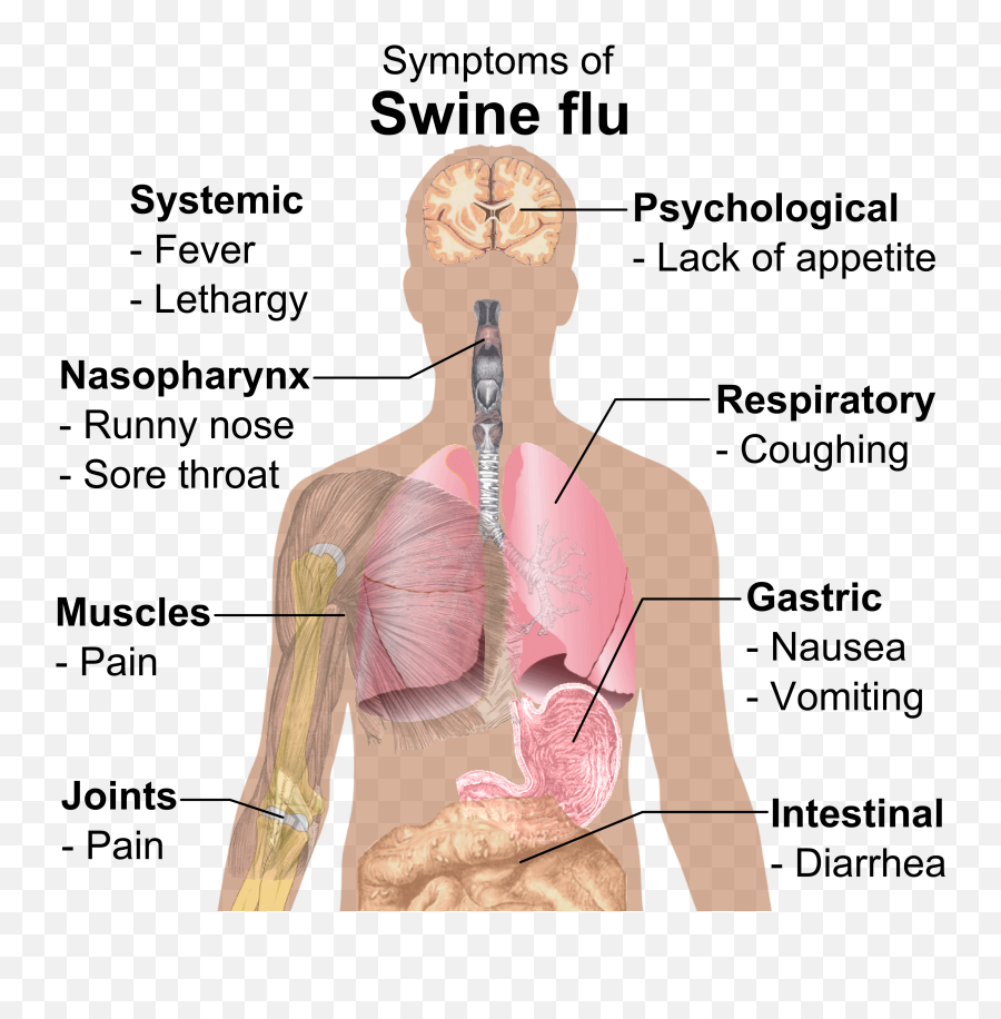Filesymptoms Of Swine Flupng - Wikimedia Commons Human Symptoms Of Swine Flu,Neck Png