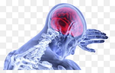 Strokes Among Younger People - Tmc News Effects On The Body Png,Skeleton Hand Png