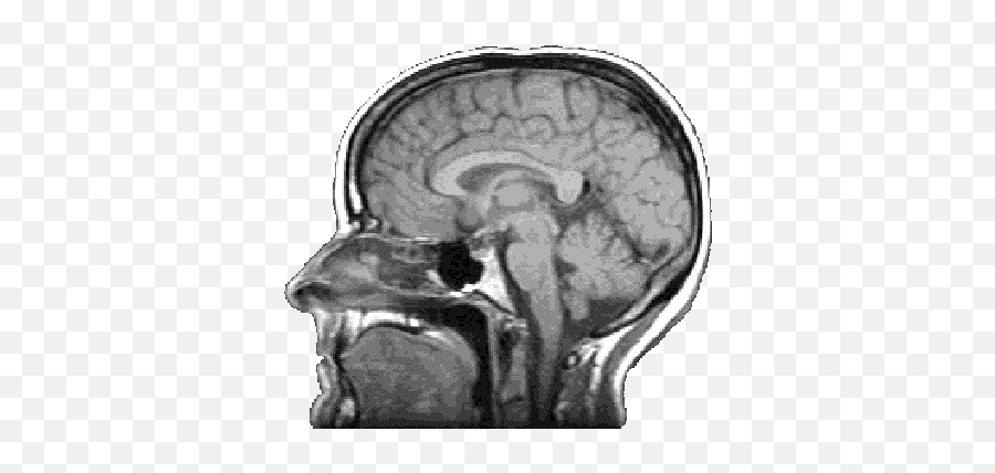 Brain Scan Transparent Background - Brain Scan Transparent Background Png,Brain Transparent Png