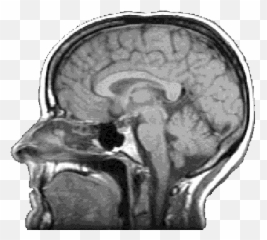 Brain Scan Transparent Background - Brain Scan Transparent Background Png,Brain Transparent Png