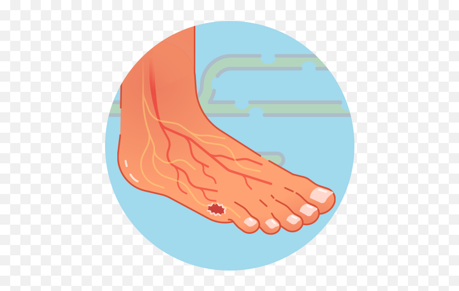 Prevent Diabetic Foot Ulcers And Avoid Amputation U2013 Home - Ankle Png,Foot Icon Vector