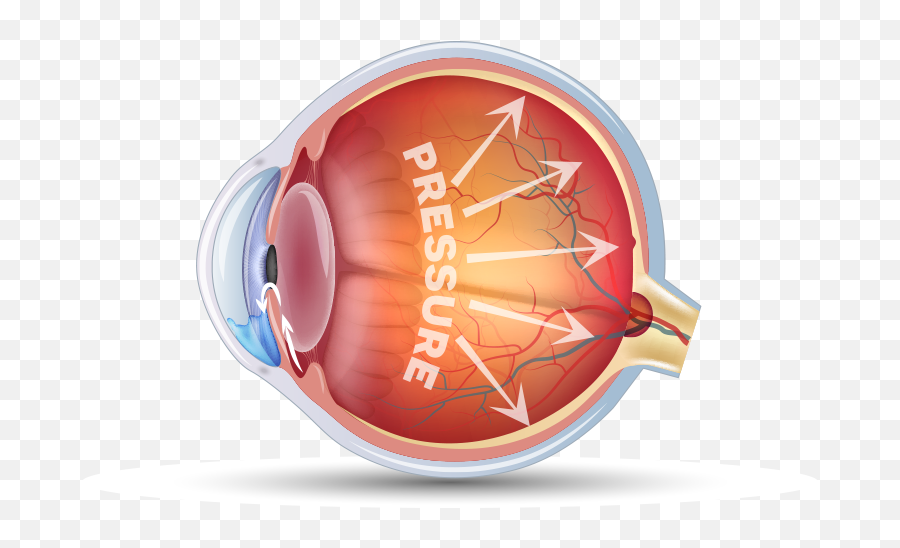 Durysta Bimatoprost Implant Patient Website - Musculo Esfinter De La Pupila Png,Showbox Eyeball Icon