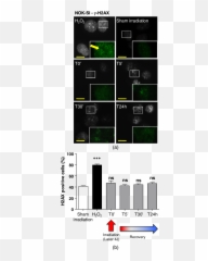 Lpt Does Not Induce Dna Strand Breaks - Vertical Png,Dna Strand Png