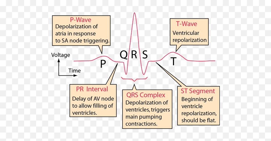 Electrocardiograms - Sa Node On Ecg Png,Ekg Png