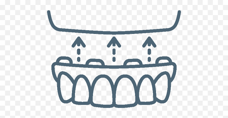 Dental Implants - Dr Pete Mellas Periodontist In Scottsdale Az Malecon Boardwalk Png,Dentures Icon