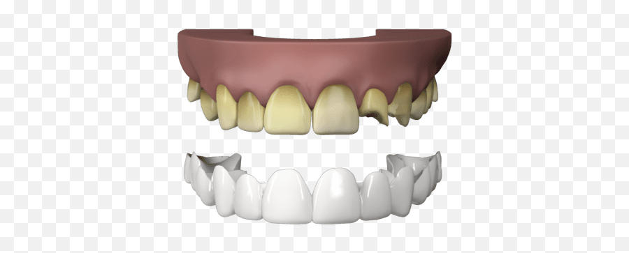 Press - Horizontal Png,Smile Teeth Png