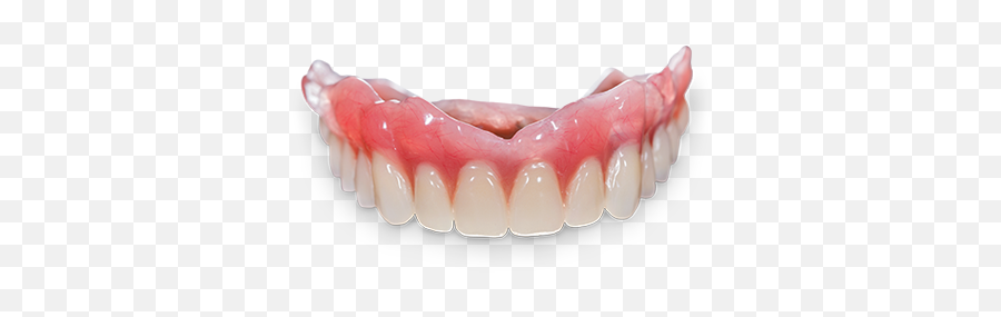 Carbon 3d Printed Digital Dentures - Burdette Dental Laboratory Dentures Png,Dentures Png