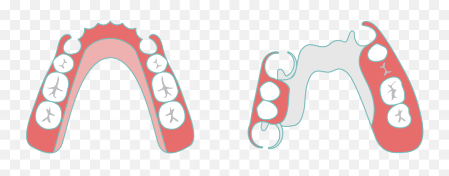 Dentures U2014 Sudbury Smiles Dentistry - Graphic Design Png,Dentures Png
