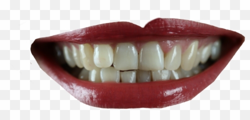 Lip Lips Smile Sticker By Thesweetness2 - Green Tea Teeth Stains Png,Creepy Smile Transparent