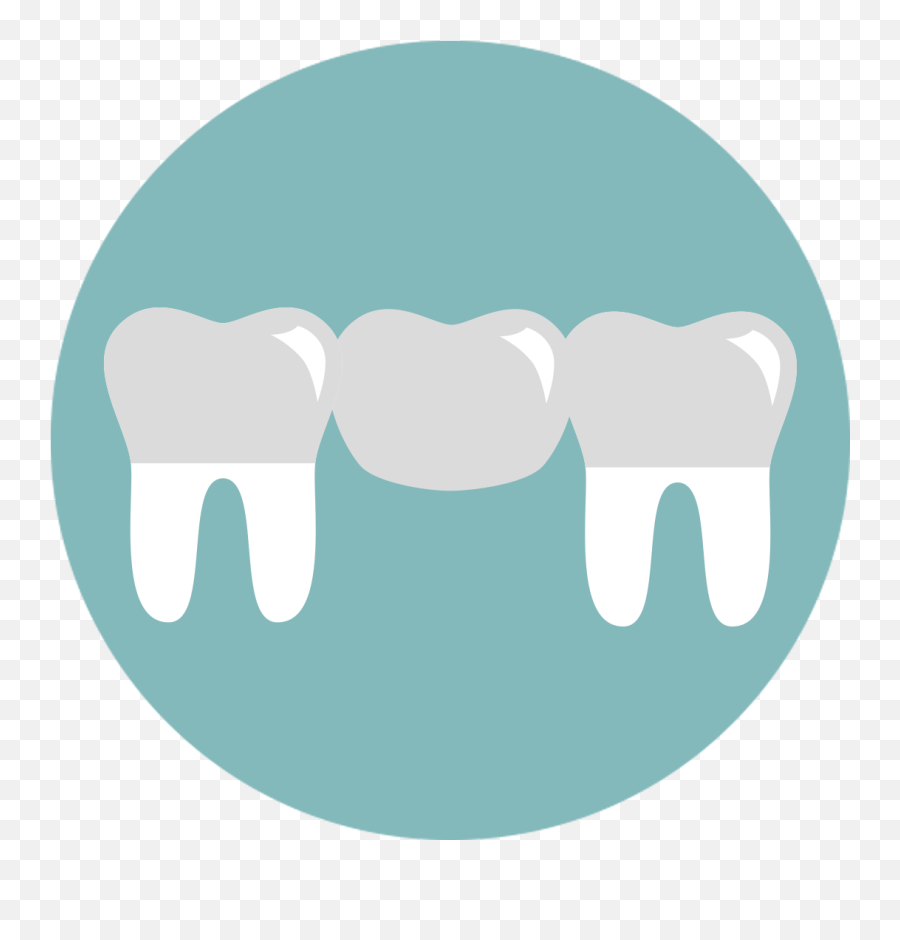 Download A Bridge Is One Method To Replace Missing Teeth - Horizontal Png,Replace Image Icon