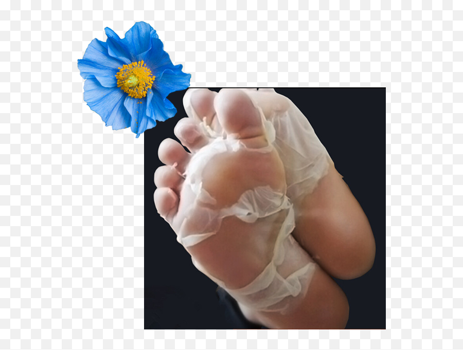 Baby Foot Treatments In Houston Peeling Exfoliating - Baby Foot Chemical Peel Png,Baby Feet Png