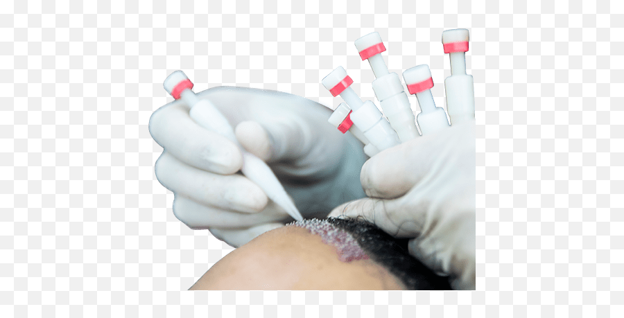 Dr Serkan Aygin Hair Transplant Clinic Turkey - Hair Transplantation Png,Master Hand Png