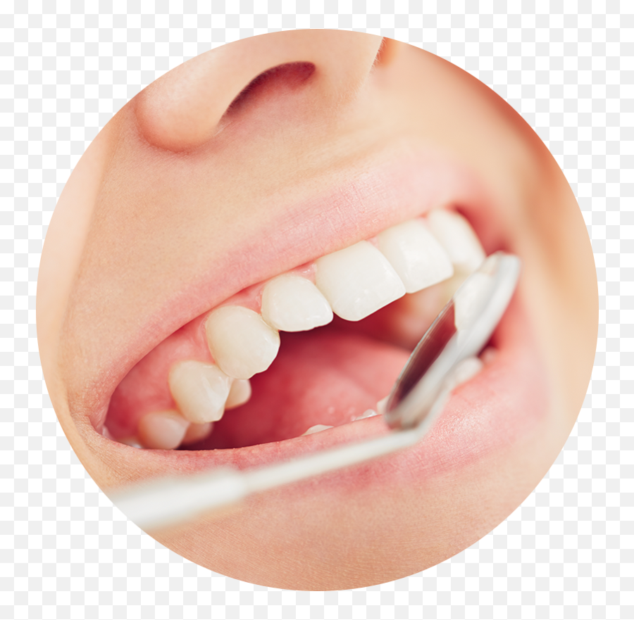 Teeth Whitening - Inside A Girls Mouth Png,Smile Teeth Png