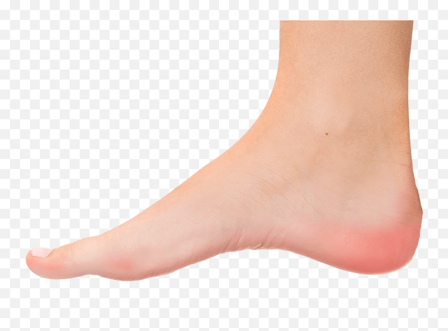 Austin Plantar Fasciitis - Transparent Foot Png,Toe Png