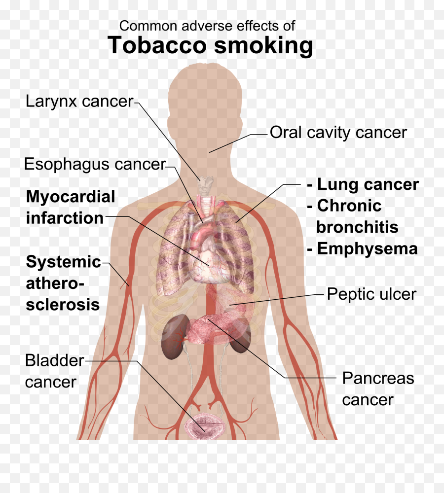 Fileadverse Effects Of Tobacco Smokingpng - Wikimedia Commons Physical Effects Of Smoking,Effects Png