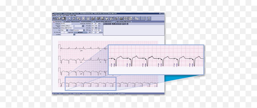 Cardiology Data Management Ge Healthcare - Muse Ekg Png,Ekg Png