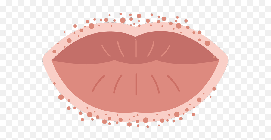 Rash Around The Mouth U0026 What Causes A Lip Buoy - Rash On Lips Png,Lipstick Icon Png