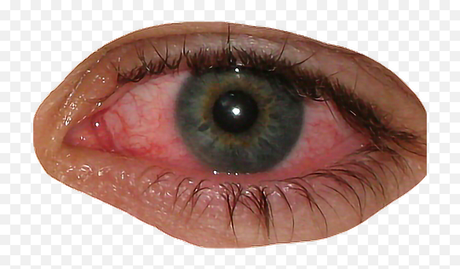 Eye Bloodshot Blood Redeye Sticker - White Pus In Corner Of Eye Png,Red Eye ...