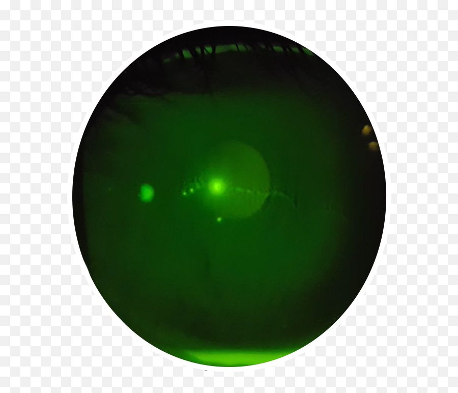 Photo Contest Png Green Lens Flare