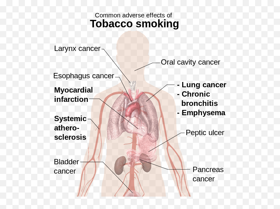 Download Hd Effects Of Smoking - Common Adverse Effects Of Common Adverse Effects Of Tobacco Smoking Png,Tobacco Png