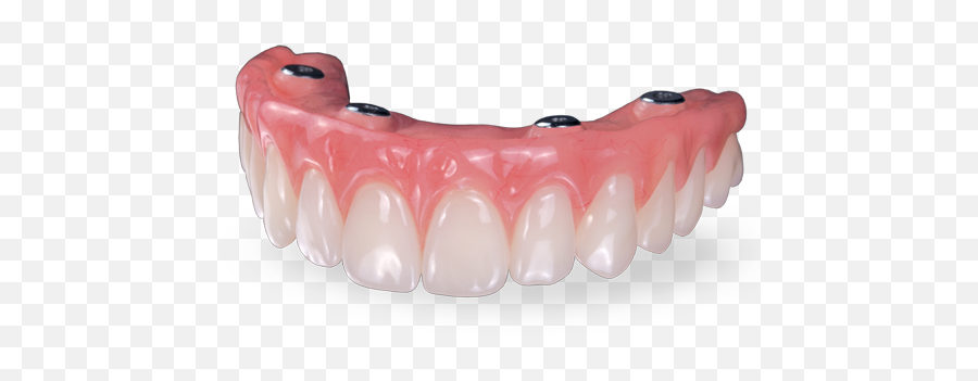 Why Is My Palateless Denture Loose - Hybrid Denture Implants Png,Jawbone Icon Earhook