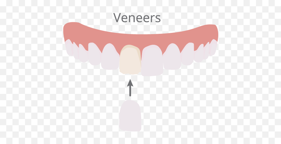 Cosmetic Dentistry In Bellevue Ne - Family Dentistry Of Bellevue Veneers Illustration Png,Smile Teeth Png