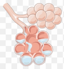 Pulmonary Edema - Servier Medical Art Furosemide Works In Pulmonary Edema Png,Lung Png