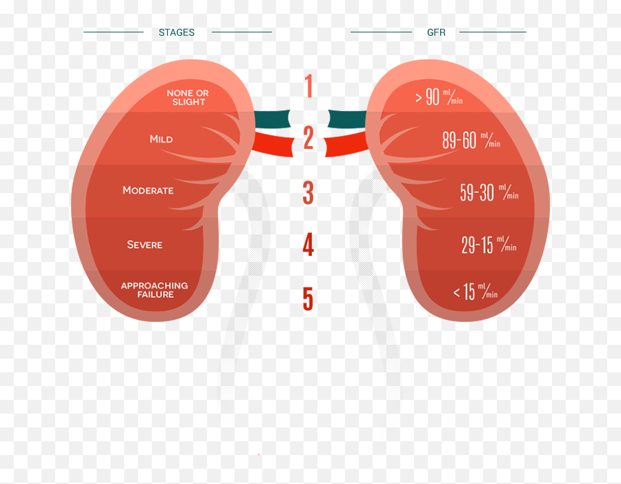 The Kidney Failure Risk Equation 1498285 - Png Images Pngio Kidney Ckd,Kidney Png