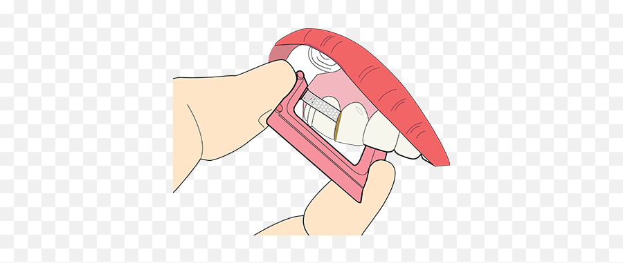 Problem Solved 4 - Interproximal Stain Removal U2014 Contacez Dentistry Png,Stain Png