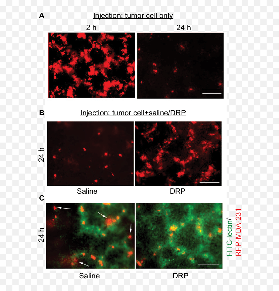 Effect Of Drp - 231 Cells Notes Screenshot Png,Lung Png