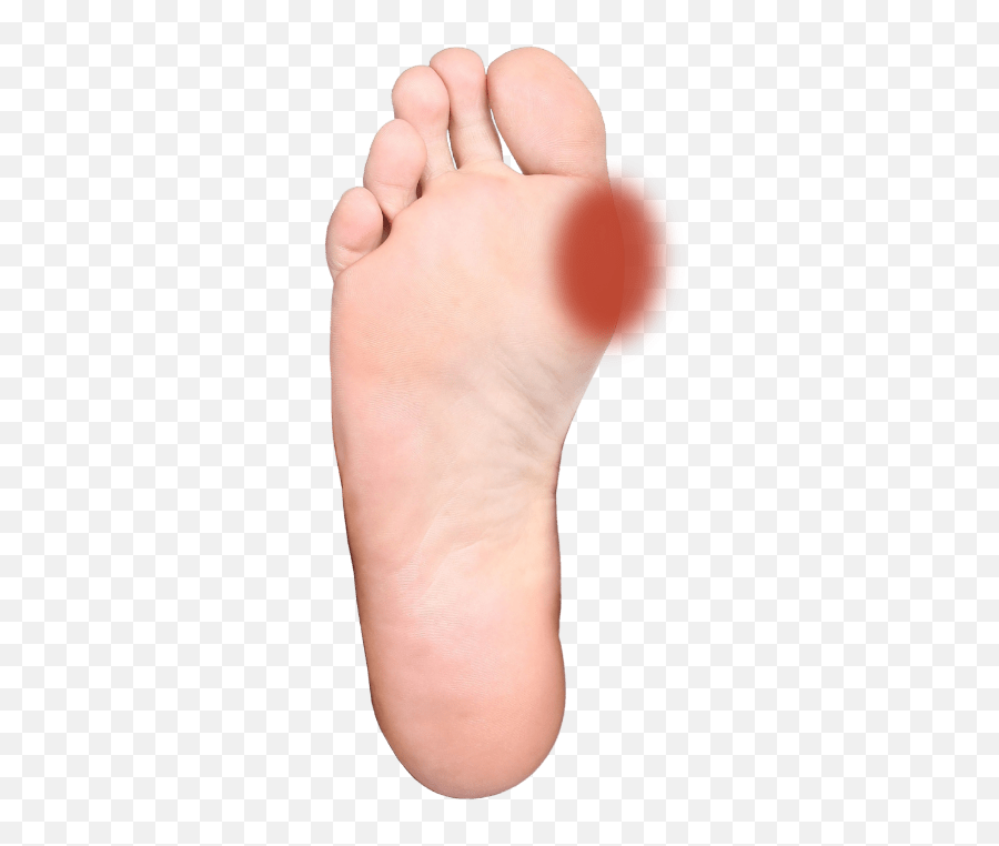 Foot Pain U2013 Common Causes And Symptoms Stryker - Does My Foot Hurt Png,Feet Transparent