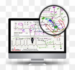 Ecg Academy - Better Way To Read ECGs Lcd png