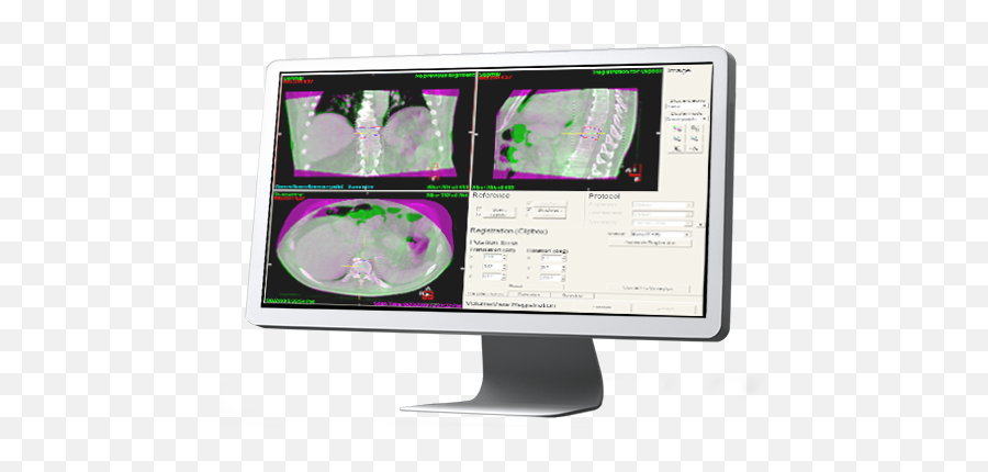 Index Of Wp - Contentuploadssites4201608 Cone Beam Ct Elekta Png,Gamma Knife Icon