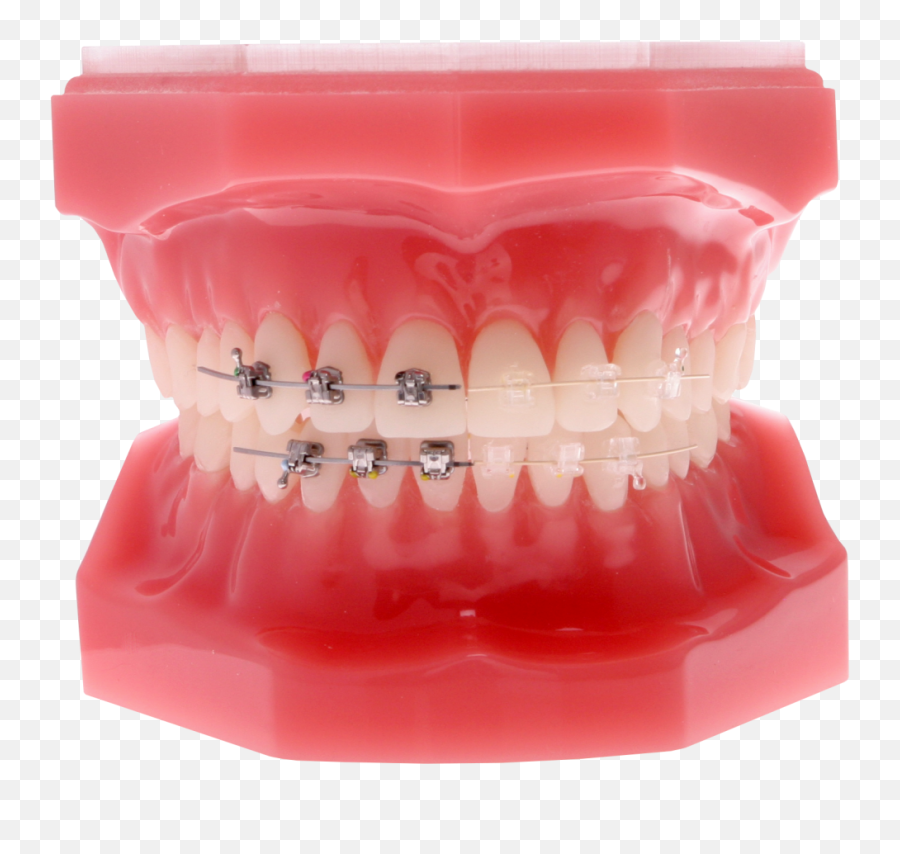 Self Ligating Clear Braces - H4go Brackets Png,Braces Png